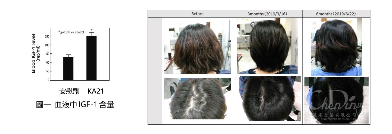增加IGF-1水平,延長頭髮的生長週期,增加髮量